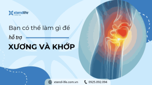 Bạn có thể làm gì để hỗ trợ xương và khớp của mình?